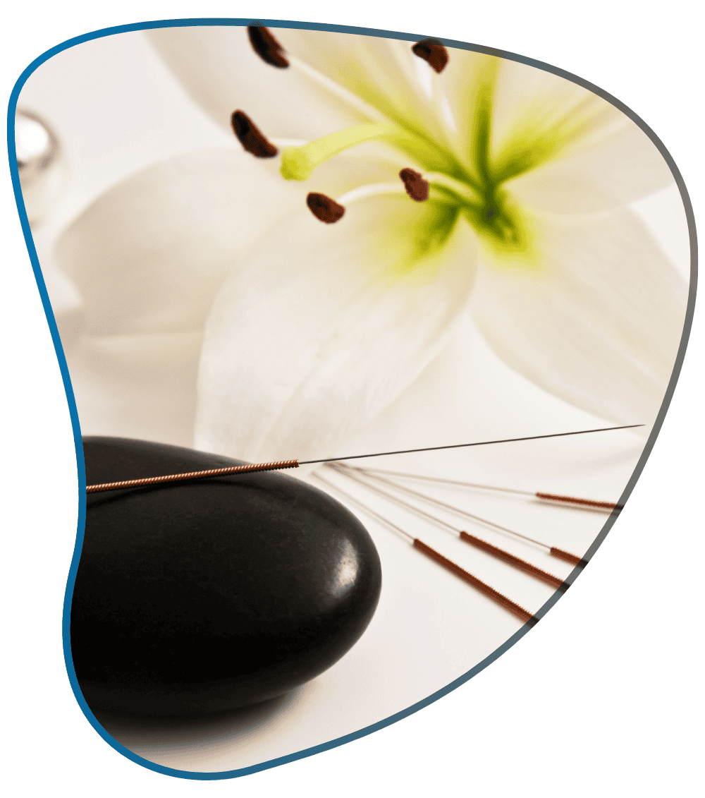 Acupuncture - 1