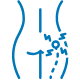 Sciatica