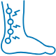 soft tissue injury